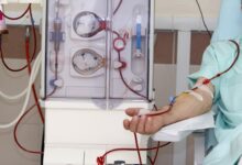 dialysis