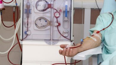 dialysis