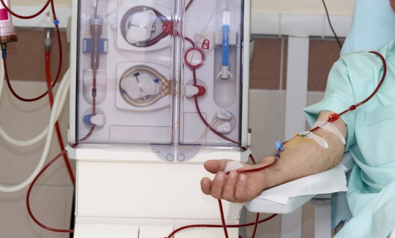 dialysis