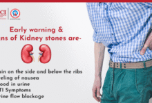 kidney stone symptoms